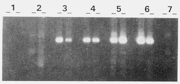 RT-PCR